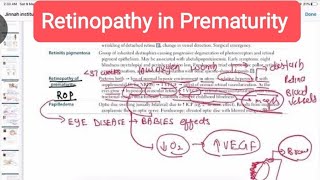 Retinopathy of prematurity Opthalmology 19 First Aid USMLE Step 1 HindiUrdu [upl. by Schuster]