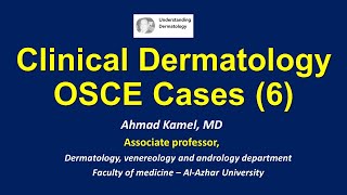 Clinical Dermatology OSCE Cases 6 [upl. by Fara]