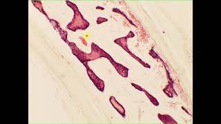 Intramembranous ossification cancellous spongy bone flatbone skull [upl. by Imer]