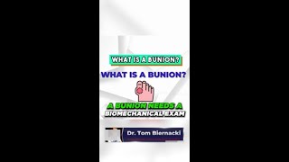 Bunion vs Arthritis Big Toe Joint Arthritis Surgery Hallux Rigidus [upl. by Joed680]