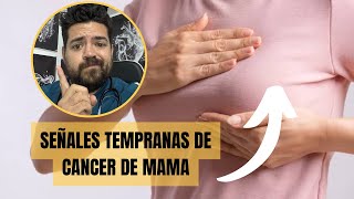 SEÑALES TEMPRANAS DE CANCER DE MAMA [upl. by Akimrehs]