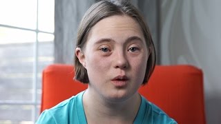 Down Syndrome Causes Signs and Symptoms Diagnosis and Treatment [upl. by Lenod]