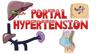 Portal Hypertension  Causes of Portal Hypertension PreIntraPost Hepatic  Symptoms amp Diagnosis [upl. by Mansfield]