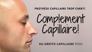 Complement Capillaire Trop Cher￼Greffe capillaire￼ ou prothèse capillaire Mon avis ￼ [upl. by Attelra]