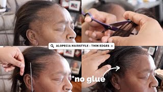 THIN EDGES TRANSFORMATION  TRACTION ALOPECIA HAIRSTYLE [upl. by Akahc898]