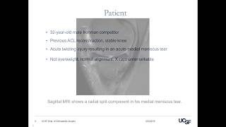 Complex Medial Meniscus Tear Repair technique [upl. by Sholley885]