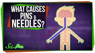 What Causes Pins and Needles [upl. by Brandy214]