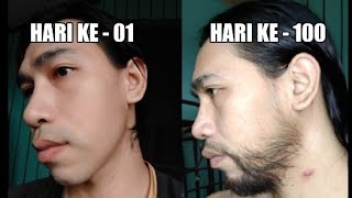 progress  Brewok Minoxidil Hari Ke 100  Minoxidil beard day 100 time lapse [upl. by Nosbig]