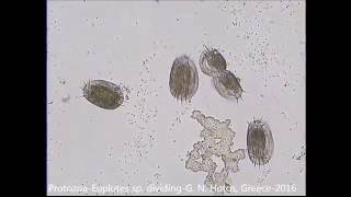 ProtozoaCiliatesEuplotes sp dividingDr G HOTOS Lab GREECE [upl. by Haig]