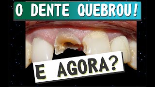 Ep 45  Meu dente quebrou e Agora [upl. by Hunt]