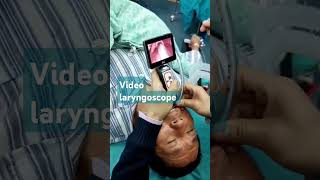 Video laryngoscope Procedure I love India hospital and all peoples ultrasoundcentre lithotripsy [upl. by Jana]