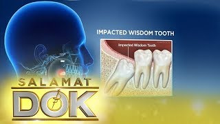 Salamat Dok Expert talks about wisdom tooth [upl. by Read]