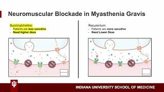 Neuromuscular Blockade in Patients w Myasthenia Gravis by Max Westlake MD Candidate Class of 2023 [upl. by Alitta]