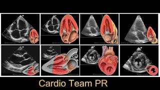 Reválida Lic Técnologo Cardiovascular PRAtenuación Consejos [upl. by Isbel]