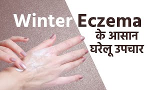 Eczema Home Remedies बदलते मौसम के कारण हो रही है एक्जिमा की समस्या तो जानें इसके घरेलू उपचार [upl. by Solnit]