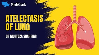 Systemic Pathology Atelectasis of Lung Dr Murtoza Shahriar [upl. by Kahcztiy607]