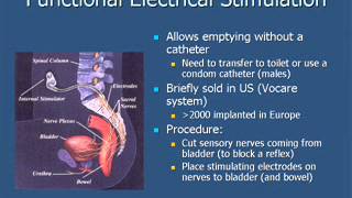 Management of Urinary Problems Caused by Spinal Cord Injury [upl. by Zaremski567]