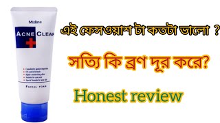 mistine acne clear face wash review ll এই ফেসওয়াশ টা কতটা ভালো [upl. by Ecinaej]