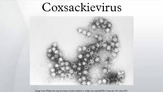 Coxsackievirus [upl. by Lewls764]