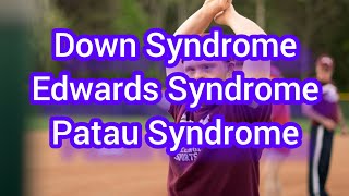 Down SyndromeEdwards Syndrome And Patau Syndrome [upl. by Aninaj622]