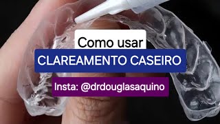 Insta drdouglasaquino  Orientação sobre clareamento caseiro de moldeira [upl. by Hallsy500]