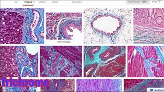 Histology stains such as eosin and hemotoxylin masons trichrome osmium tetroxide and more [upl. by Angelis]