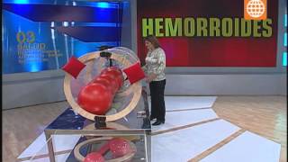 Dr TV  Cómo tratar las hemorroides  090713 [upl. by Hefter896]