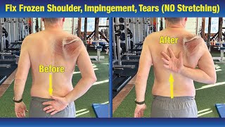 INCREDIBLE way to Fix Frozen Shoulder amp Impingement  NO Stretching or PT Exercises [upl. by Farrica]