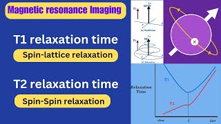 T1 Relaxation amp T2 Relaxation ll magnetic resonance imaging ll Radiography simplified [upl. by Zamir]