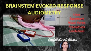 209Brainstem Evoked Response Audiometry BERA Part 12 brain auditory evoked response bera [upl. by Raila]