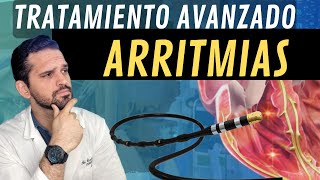 MIRA¡ Asi es un Estudio ELECTROFISIOLÓGICO y ABLACIÓN en arritmias 💥 [upl. by Nanon]