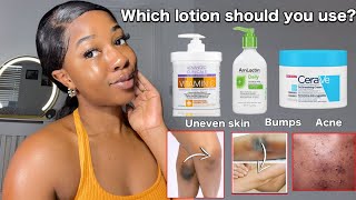 THE BEST BODY LOTIONS FOR UNEVEN SKIN  BODY ACNE  BUMPY SKIN  Fast working lotions‼️ [upl. by Meggy]