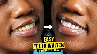 How to WHITEN TEETH in Photoshop  Easy Retouching Tutorial [upl. by Aneekan]