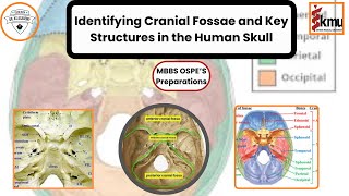 OSPE Preparation Identifying Cranial Fossae and Key Structures in the Human Skull  Dr KS Academy [upl. by Nedarb834]