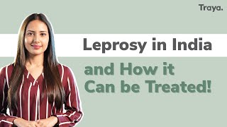 Leprosy in India and how it can be treated  World Leprosy Day [upl. by Yalonda]