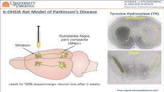 Mead  MRgFUS Delivery of BrainPenetrating Gene Vectors Reverses Neurodegeneration PD Model 2016 [upl. by Sirdna544]