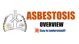 AsbestosisOverview…All explained easytoremember [upl. by Adnerb370]