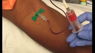 Phlebotomy Procedure Venipuncture with 21G Butterfly education phlebotomy tutorials [upl. by Eloc514]