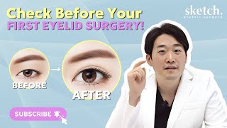 First Eyelid Surgery  Plastic Surgeons Guidance on What to Expect When Getting Eyelid Surgery [upl. by Christiana996]