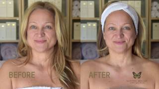 CRYO FACELIFT™  ICE CUBE TREATMENT [upl. by Noak]