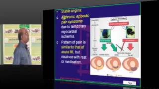 NEETPG Coaching Medicine Cardiology Topic 01 Coronary artry disease Part 03 [upl. by Ahsiuqal]