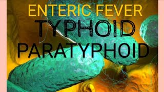 Enteric Fever  Typhoid fever  Paratyphoid Fever  Medicine  Microbiology [upl. by Apps]