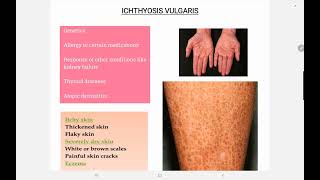 Ichthyosis Vulgaris [upl. by Nasia]