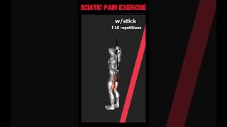 I RELIEVED Sciatic Pain with Gentle Exercises [upl. by Onitnevuj80]