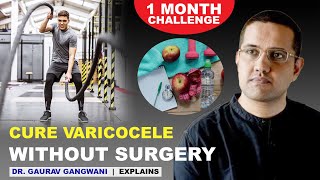 Varicocele natural treatment  Varicocele treatment without any surgery  Dr Gaurav Gangwani [upl. by Enair]