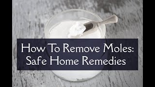 How To Remove Moles Safe Home Remedies [upl. by Byran]