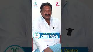 Suffering From Varicose Veins Since 20 Years  Avis Hospitals  shorts ytshorts [upl. by Alverta]