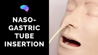 Nasogastric NG Tube Insertion  OSCE Guide  UKMLA  CPSA [upl. by Nyladnor986]