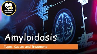 Amyloidosis Types Causes amp Treatment [upl. by Lindberg784]