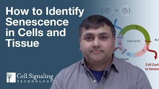 How to Identify Senescence in Cells and Tissue  CST Tech Tips [upl. by Ayifa413]